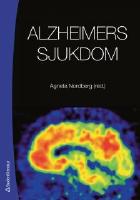 Alzheimers sjukdom