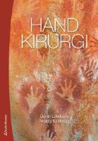 Handkirurgi