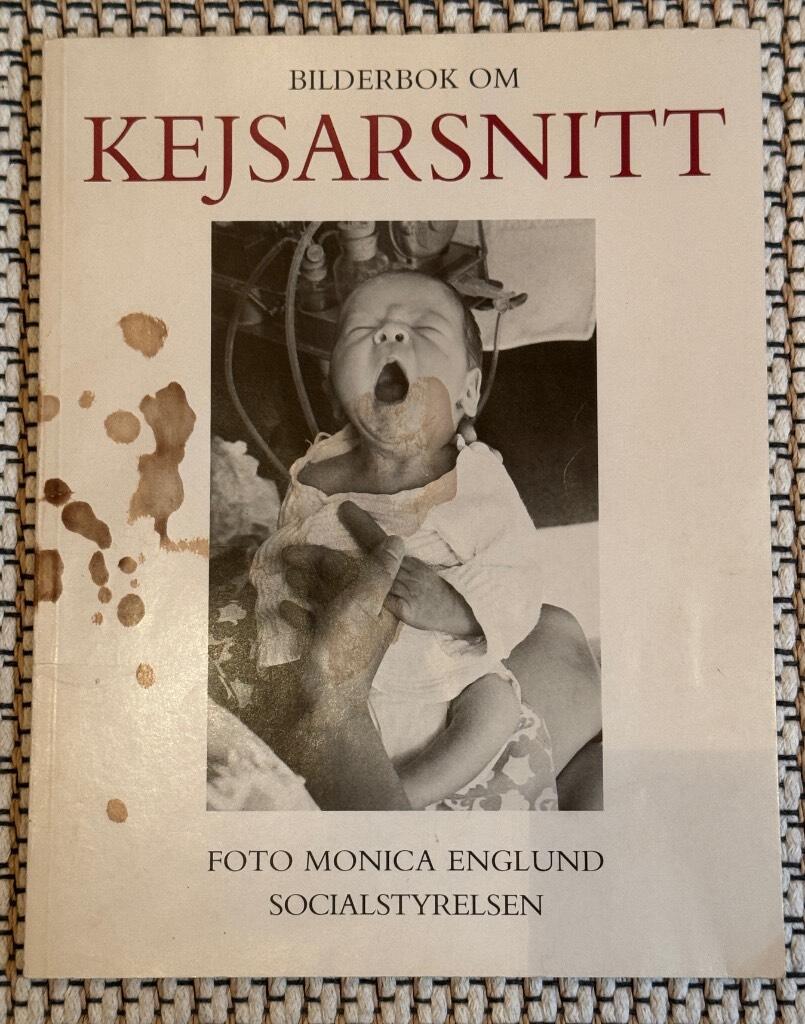 Bilderbok om kejsarsnitt