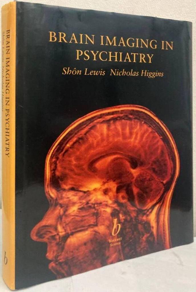 Brain imaging in psychiatry