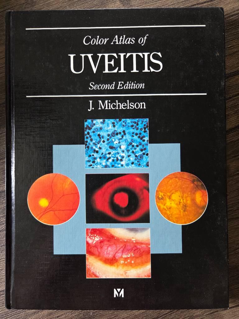 A colour atlas of uveitis