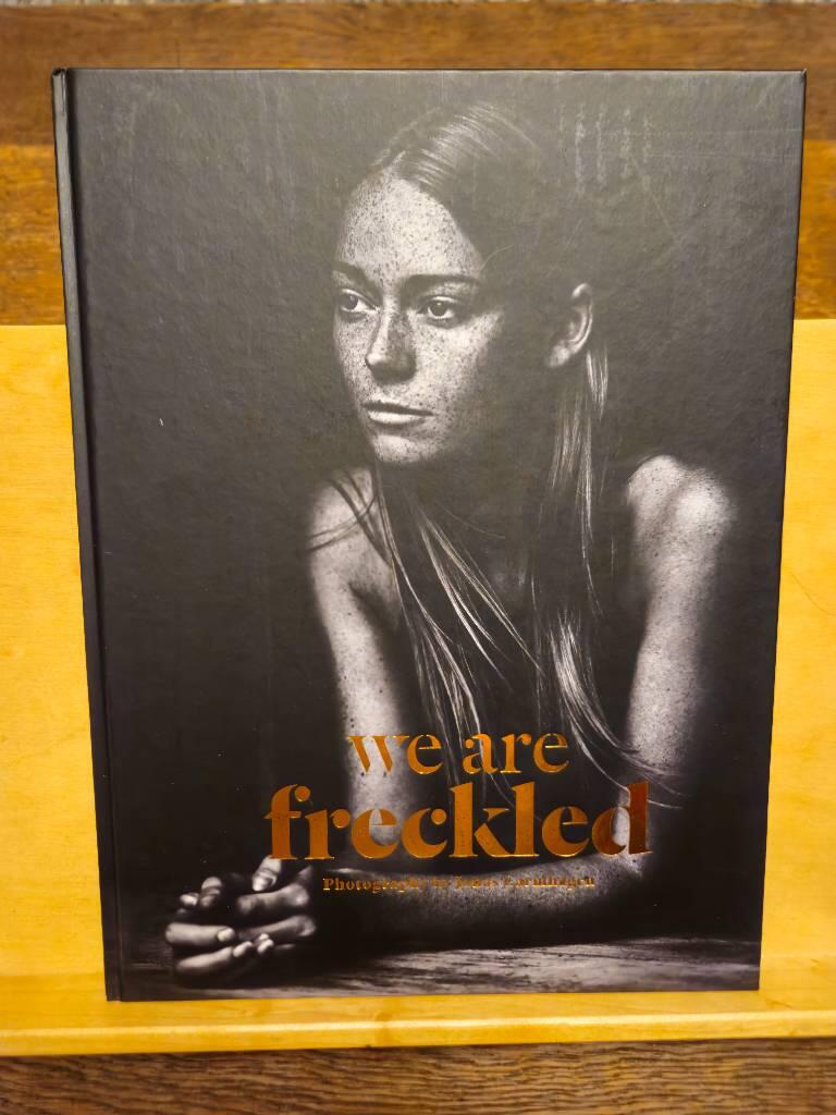 We are freckled
