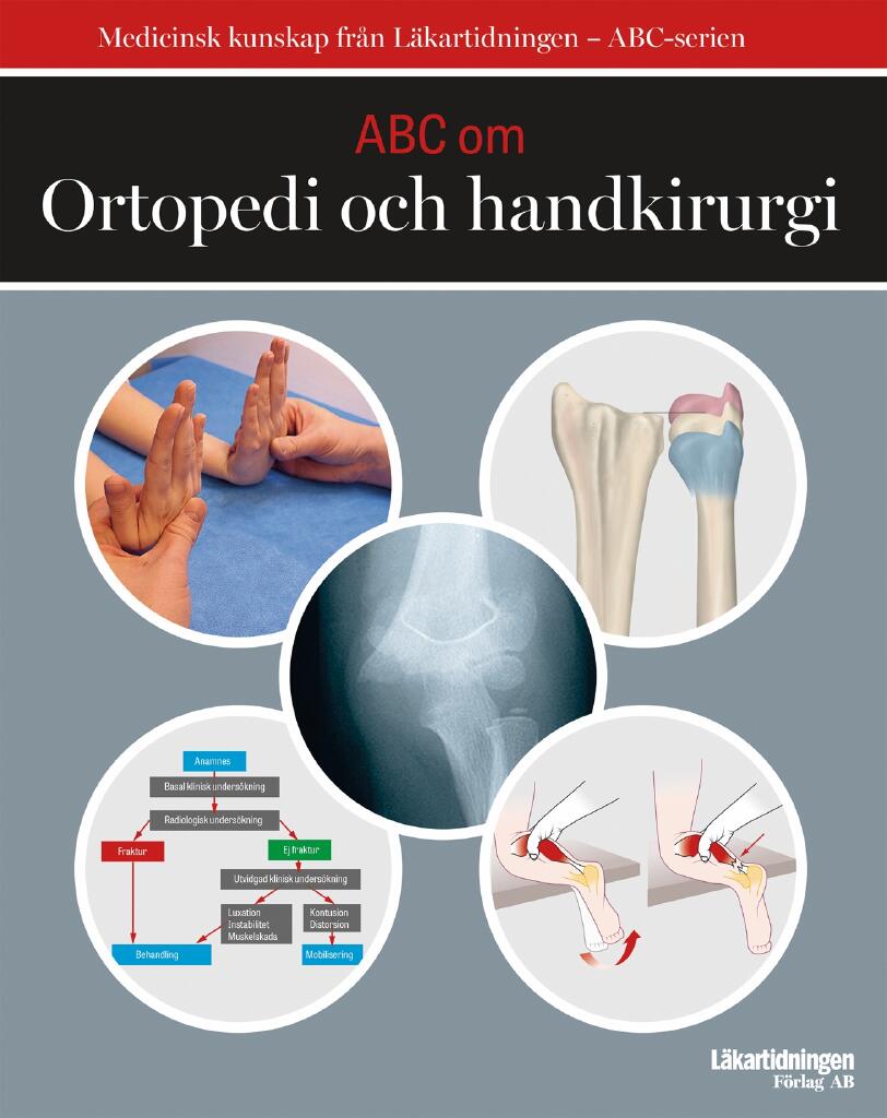 ABC om ortopedi och handkirurgi