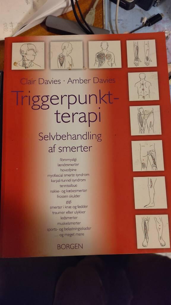 Triggerpunktterapi
