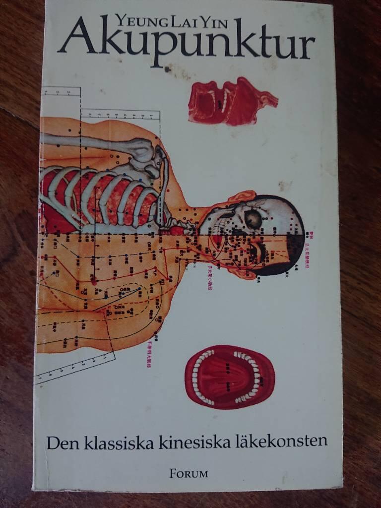 Akupunktur  ny uppl.