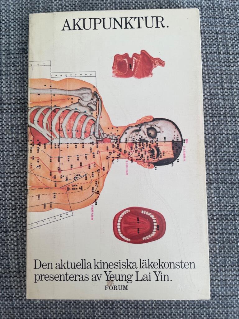 Akupunktur : den aktuella kinesiska l&auml;kekonsten