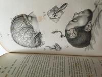 Pr&eacute;cis Iconographique M&eacute;decine Op&eacute;ratoire et d'anatomie chirurgicale