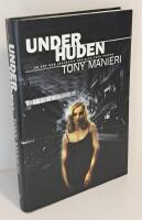 Under huden