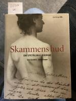Skammens hud, om spet&auml;lska i Sverige