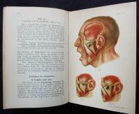 Atlas und Grundriss der traumatischen Frakturen und Luxationen. (Lehmann´s Medicin. Handatlanten. Band VIII.)