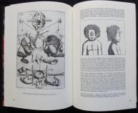 The byrth of mankynde otherwyse named the womans booke. Embryology obstetrics gynaecology through four centuries. An illustrated and annotated catalogue of rare books in the library of the Swedish Society of Medicine