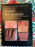 A colour atlas of allergic skin disorders