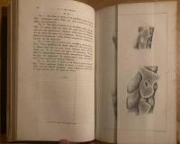 Medicinskt archiv. Utgifvet af l&auml;rarne vid Carolinska Institutet i Stockholm. Andra bandet