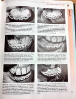 Equine dentistry