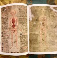 Ardernes Practica : master John Arderne fr&aring;n Newark och hur han ut&ouml;vade medicin och kirurgi, 1412