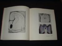 Torsten Andersson : [Moderna museet, Stockholm 25 oktober 1986-11 januari 1987, Malm&ouml; konsthall 28 februari-12 april 1987]