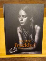 We are freckled