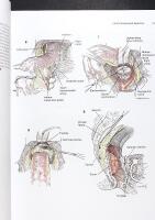 Zollinger's ATLAS OF SURGICAL OPERATIONS