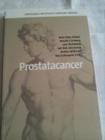 Prostatacancer. Karolinska institutets forskare skriver