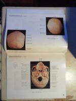 Principles of anatomy and physiology