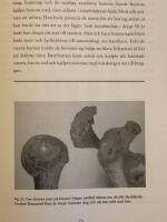 &Aring;derf&ouml;rkalkning och portvinst&aring;r : v&auml;lf&auml;rdssjukdomar i medeltidens &Aring;hus