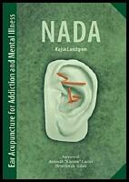 NADA : Ear acupuncture for addiction and mental illness