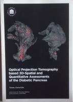 Optical Projection Tomography based 3D-Spatial and Quantitative Assesments of the Diabetic Pancreas